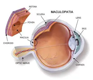 Maculopatia: EyeMax, la Nuova Terapia