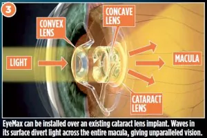EyeMax -