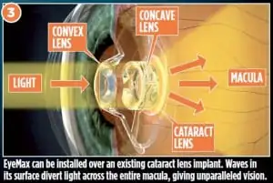 EyeMax